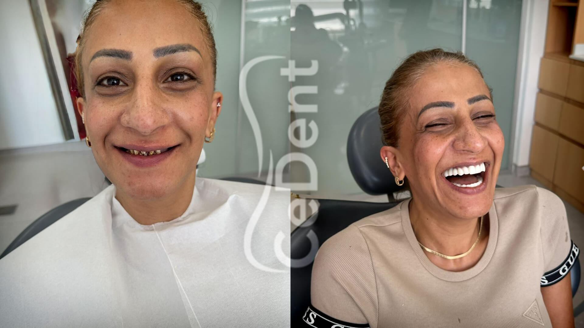İtalyan İmplant Markaları